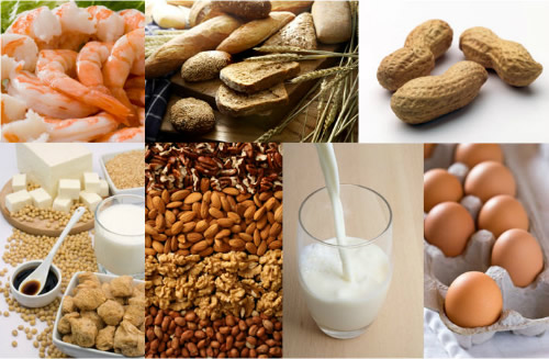 Từ vụ sốc phản vệ sau ăn cá thu, khuyến cáo những loại okviphoatdong dễ gây dị ứng, cần thận trọng khi ăn - Ảnh 2