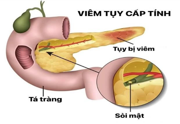 Chuyên gia cảnh báo 6 mối nguy với okvip88 khi tham gia thử thách 'suất ăn khổng lồ' - Ảnh 2