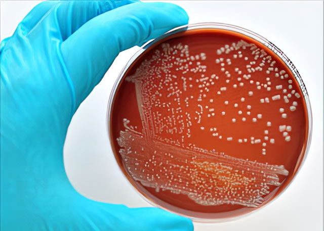 Vi khuẩn E.Coli không 'lành' như bạn vẫn nghĩ và 5 chìa khóa phòng liên minh okvip okviphoatdong - Ảnh 3