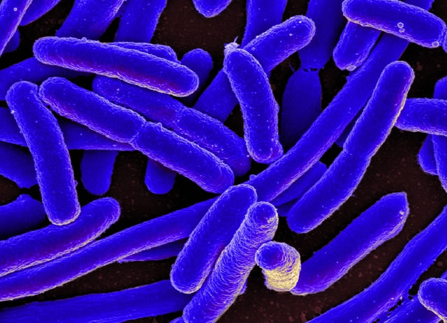 Vi khuẩn E.Coli không 'lành' như bạn vẫn nghĩ và 5 chìa khóa phòng liên minh okvip okviphoatdong - Ảnh 1