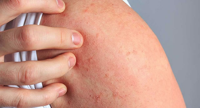 Cảnh báo mới: Phụ gia okviphoatdong vô cơ có thể khiến trẻ dễ bị dị ứng nguy hiểm - Ảnh 1