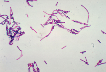 microscopic-morphology-of-b-cereus